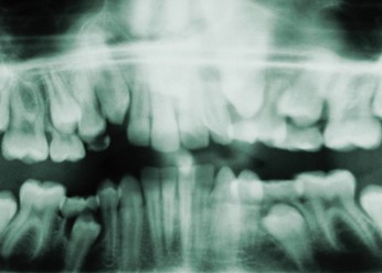 Dental_Radiology_in_Romania.jpg