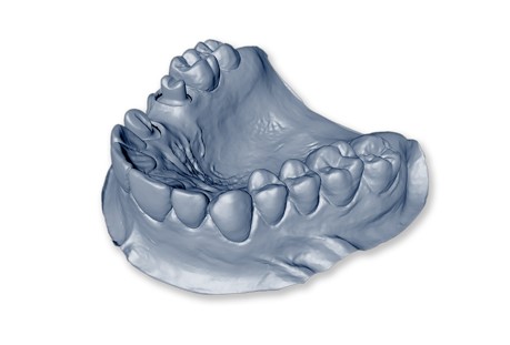 Implant-Dentar-Alpha-Bio-in-Romania.jpg