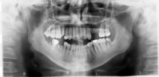 Radiologie dentaire en Roumanie